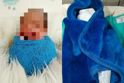 Bayi prematur dengan berat 1,5 kg meninggal dunia usai dijadikan konten. (Instagram @nadiaanastasyasilvera)