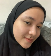 Tahi Lalat Tak Sekadar Tanda Kulit, Primbon Jawa Baca 38 Letaknya sebagai Isyarat Hidup