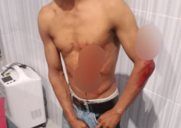 Keributan Pesta, Pelaku Z Tusuk SP di Jiken Blora