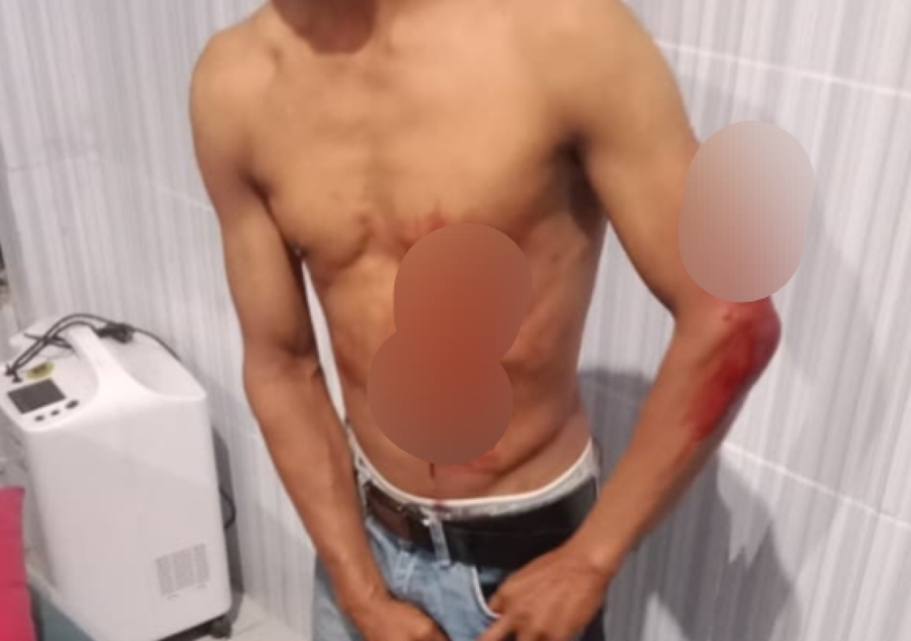Keributan Pesta, Pelaku Z Tusuk SP di Jiken Blora